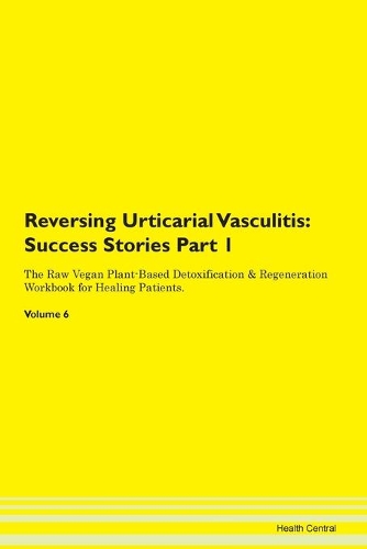 Reversing Urticarial Vasculitis