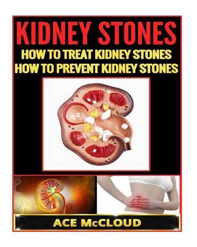 Kidney Stones: How to Treat Kidney Stones: How to Prevent Kidney Stones(English)