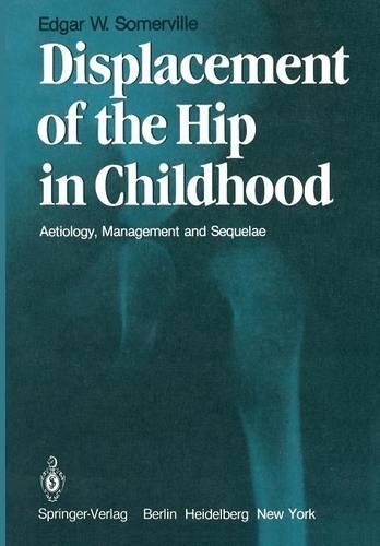 Displacement of the Hip in Childhood