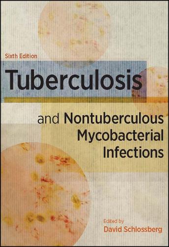 Tuberculosis and Nontuberculous Mycobacterial Infections,
