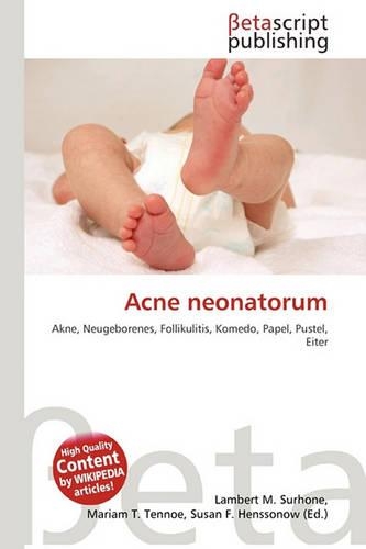 Acne Neonatorum