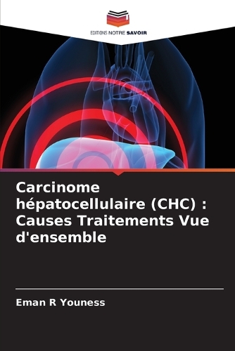 Carcinome hépatocellulaire (CHC): Causes Traitements Vue d'ensemble
