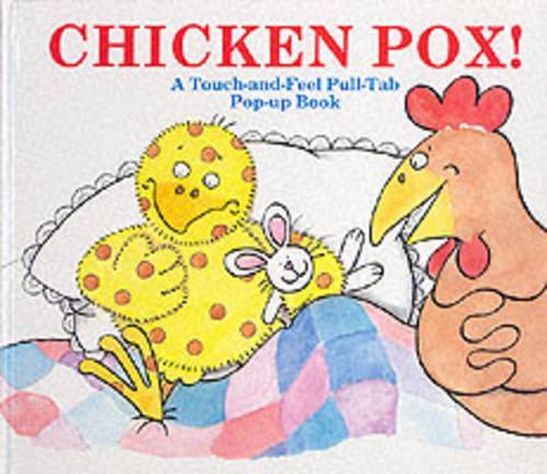 Chicken Pox!