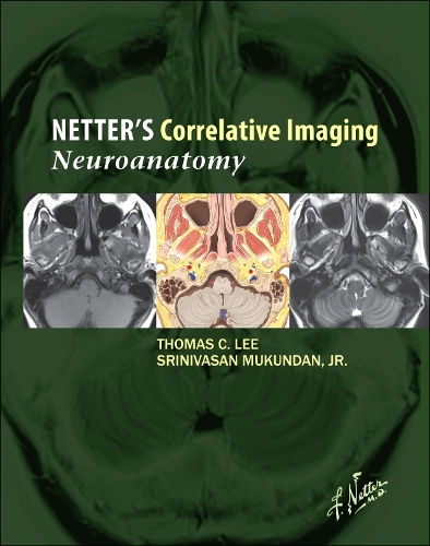 Netter's Correlative Imaging: Neuroanatomy with Access Code: Neuroanatomy: With Netterreference.com Access