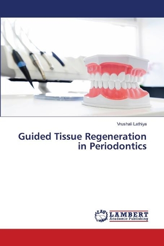 Guided Tissue Regeneration in Periodontics