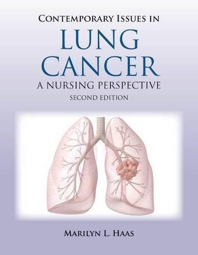 Contemporary Issues in Lung Cancer