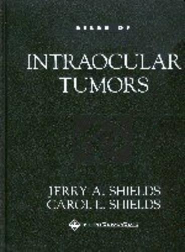 Atlas of Intraocular Tumors