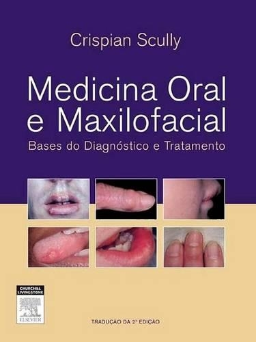 Medicina Oral E Maxilofacial