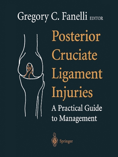 Posterior Cruciate Ligament Injuries: A Practical Guide to Management(English)