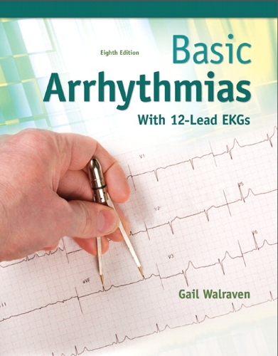 Basic Arrhythmias