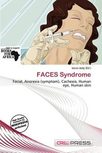 Faces Syndrome
