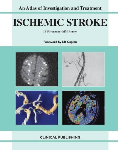Ischemic Stroke: An Atlas of Investigation and Treatment