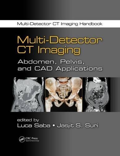 Multi-Detector CT Imaging: (Multi-Detector CT Imaging Handbook)