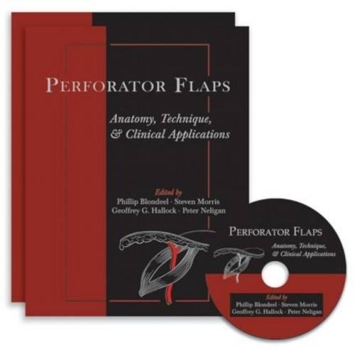 Perforator Flaps