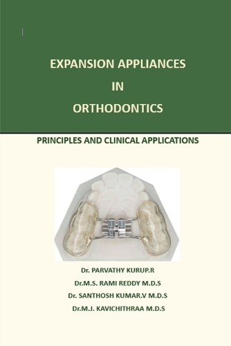 Expansion Appliance in Orthodontics