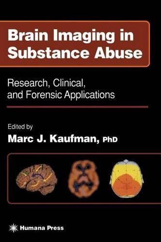Brain Imaging in Substance Abuse. Forensic Science and Medicine.: (Forensic Science and Medicine)