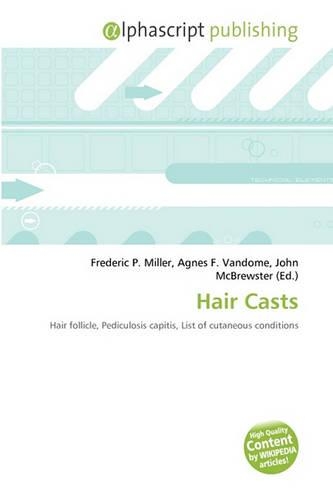 Hair Casts: (English)