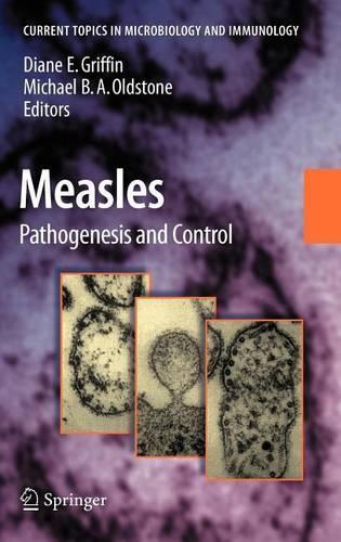 Measles: Pathogenesis and Control