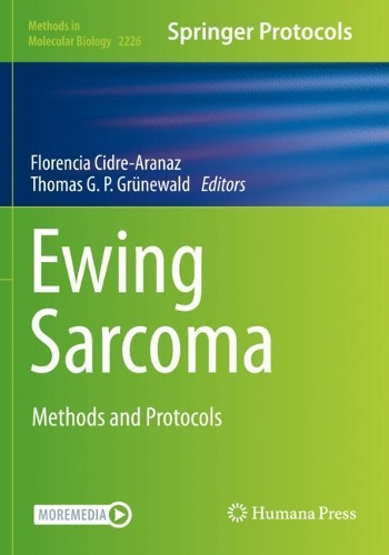 Ewing Sarcoma
