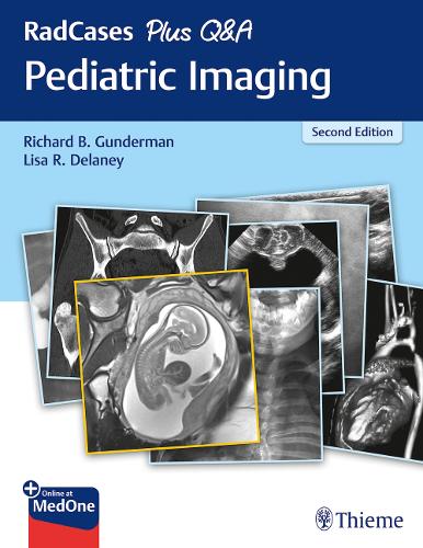 RadCases Plus Q&a Pediatric Imaging: (Radcases Plus Q&a)