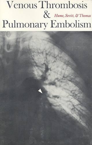 Venous Thrombosis and Pulmonary Embolism
