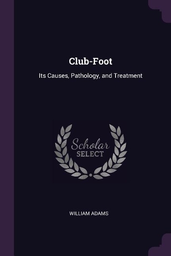 Club-Foot: Its Causes, Pathology, and Treatment