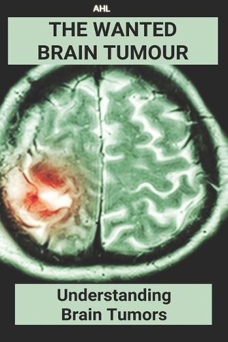 The Wanted Brain Tumour