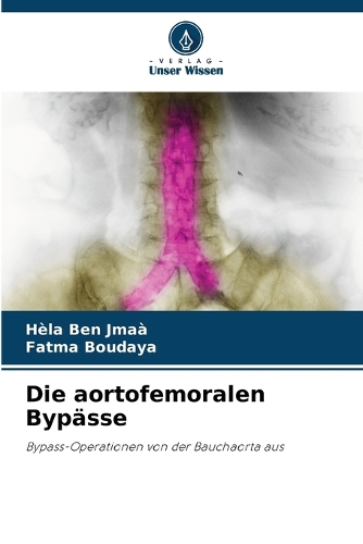 Die aortofemoralen Bypässe