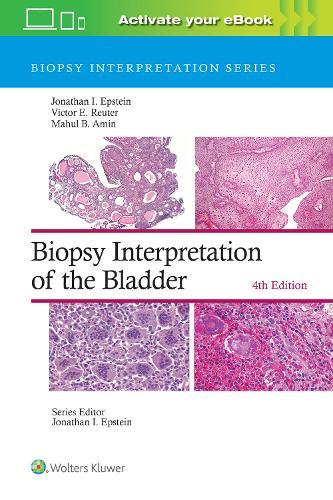 Biopsy Interpretation of the Bladder: Print + eBook with Multimedia: (Biopsy Interpretation Series)