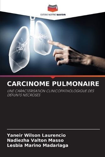 Carcinome Pulmonaire