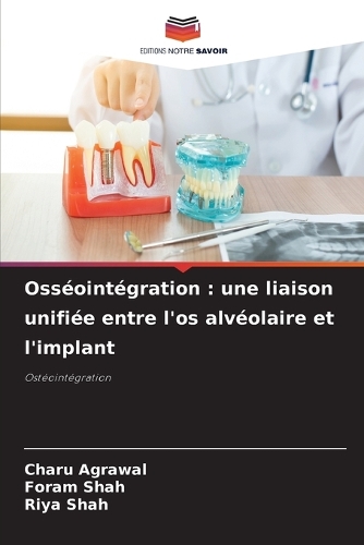 Osséointégration: une liaison unifiée entre l'os alvéolaire et l'implant(6 Texas Firebrand)