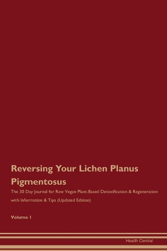 Reversing Your Lichen Planus Pigmentosus