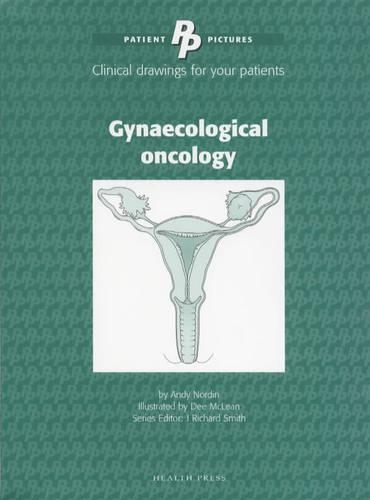 Gynaecological Oncology