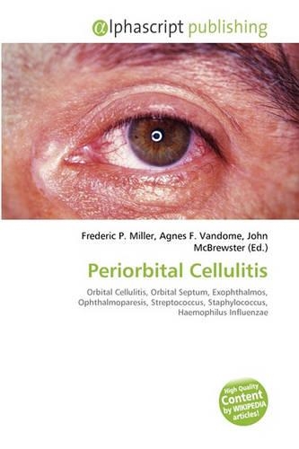 Periorbital Cellulitis