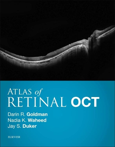 Atlas of Retinal Oct E-Book