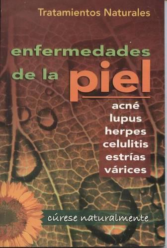 Tratamientos Naturales Para Enfermedades de la Piel: (RTM Ediciones)
