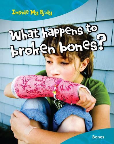 Inside My Body What Happens to Broken Bones?