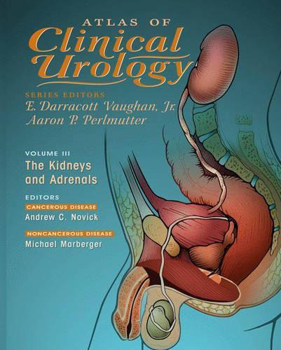 Atlas of Clinical Urology: The Kidneys and Adrenals(Atlas of Clinical Urology)