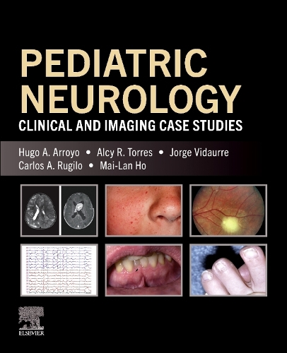 Pediatric Neurology - eBook