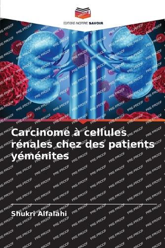 Carcinome à cellules rénales chez des patients yéménites