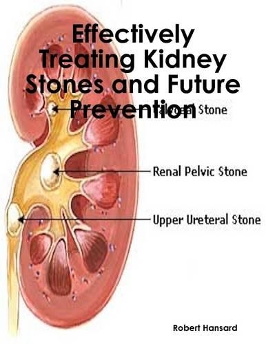 Effectively Treating Kidney Stones and Future Prevention
