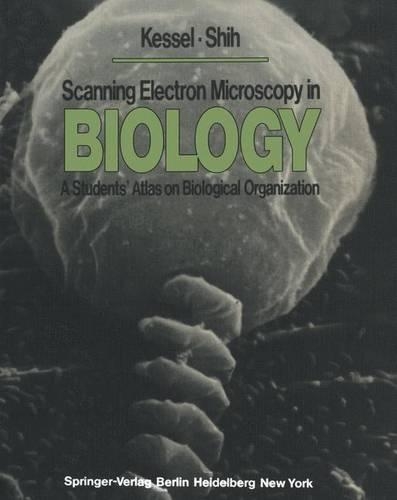 Scanning Electron Microscopy in Biology