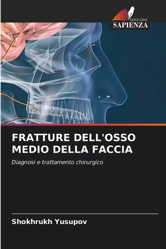 Fratture Dell'osso Medio Della Faccia