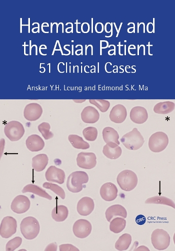Haematology and the Asian Patient