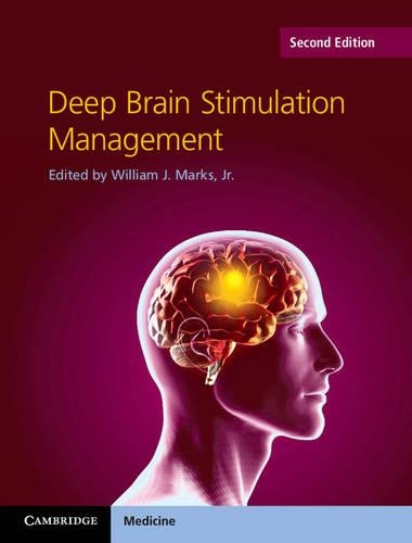 Deep Brain Stimulation Management