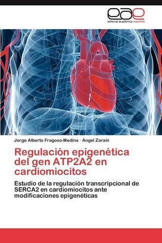 Regulacion Epigenetica del Gen Atp2a2 En Cardiomiocitos: (Spanish)