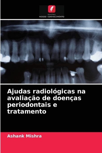 Ajudas radiológicas na avaliação de doenças periodontais e tratamento