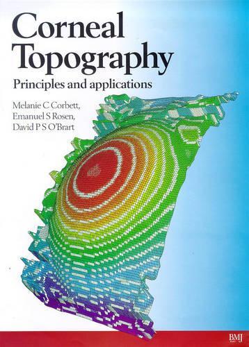 Corneal Topography