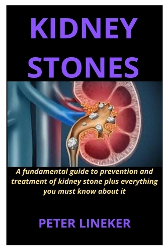 Kidney Stones