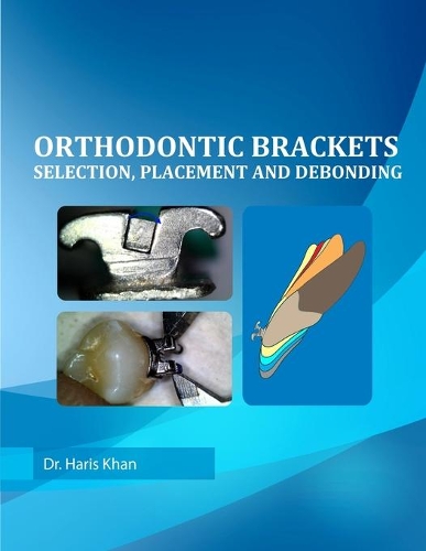 Orthodontic Brackets